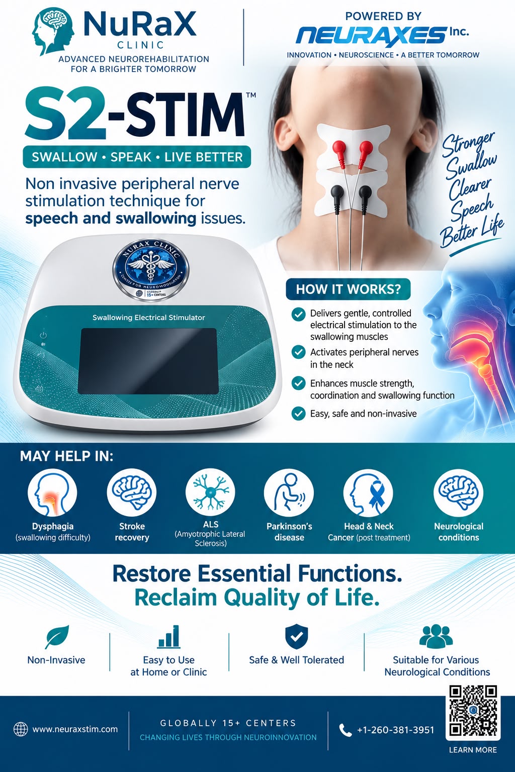 S2-STIM — Swallowing Electrical Stimulator